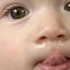 赤ちゃんの鼻水が治らない何かの病気！？原因と対処法とおすすめの食材