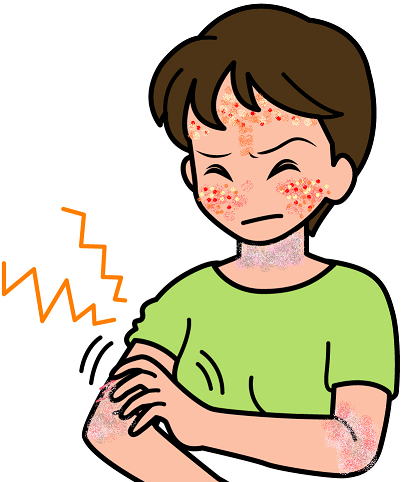 顔や体に湿疹やかぶれが出るアレルギー性の皮膚炎