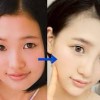 HKT48の整形モンスター・兒玉遥のアバター顔面と鼻筋を高須院長が指摘！【画像】
