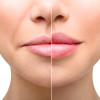 老け顔対策に！ほうれい線が本当に消えるおすすめの美容液3選 