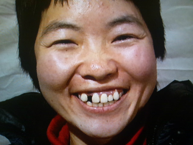 前歯を1本失ってしまった頃のイモトアヤコさん